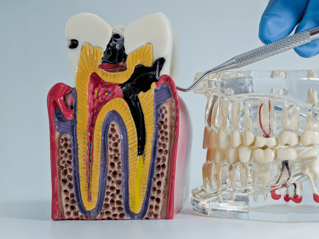 Endodontinis gydymas