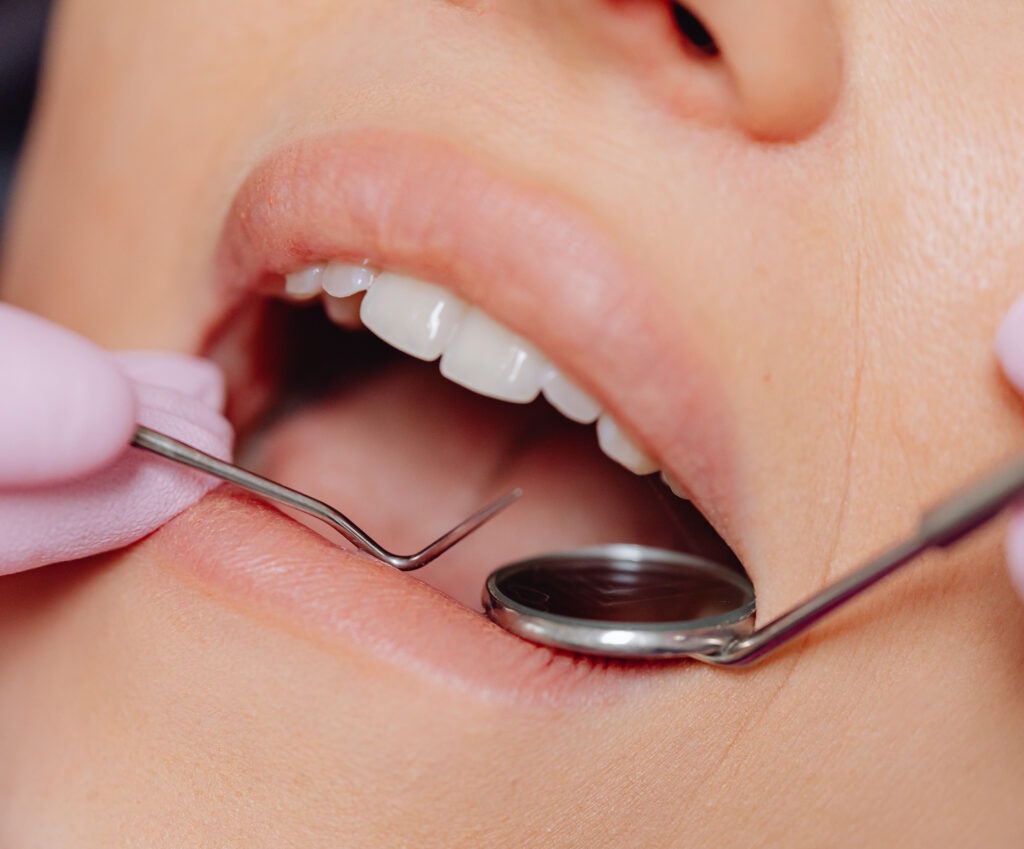 Periodontologinis gydymas
